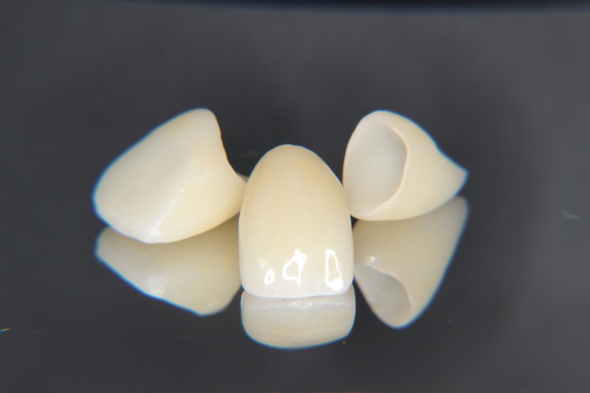 診療内容｜坂井輪ライト歯科